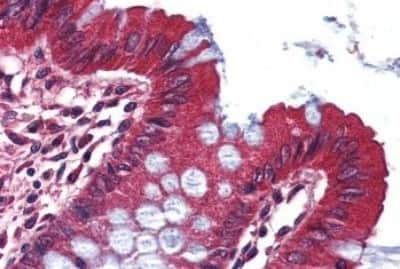 Immunohistochemistry-Paraffin: Kv1.3 Antibody [NBP3-14388] - Immunohistochemistry of formalin-fixed, paraffin-embedded human colon after heat-induced antigen retrieval.